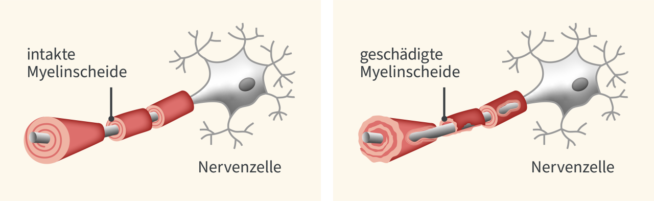 nervenzelle-myyelinscheide
